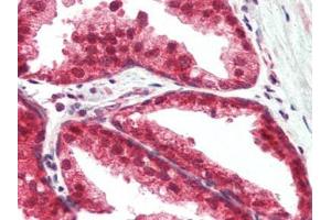 Human Prostate (formalin-fixed, paraffin-embedded) stained with TSLPat 2. (Thymic Stromal Lymphopoietin anticorps)