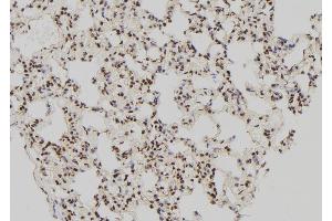 ABIN6276288 at 1/100 staining Rat lung tissue by IHC-P. (ATF4 anticorps)