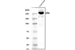 Western blot analysis of MYH6 using anti-MYH6 antibody (ABIN7603070).