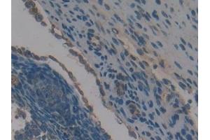 Detection of NB1 in Mouse Ovary Tissue using Polyclonal Antibody to Neutrophil Specific Antigen 1 (NB1)