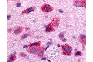 Anti-S1PR5 / EDG8 antibody IHC of rat brain, neurons and glia.