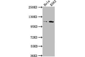 Western Blot Positive WB detected in: Hela whole cell lysate, K562 whole cell lysate All lanes: PIK3CB antibody at 1:1500 Secondary Goat polyclonal to rabbit IgG at 1/50000 dilution Predicted band size: 123 kDa Observed band size: 110 kDa