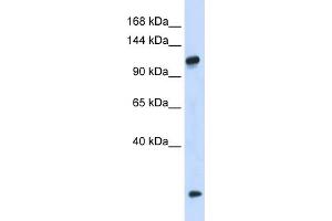 WB Suggested Anti-HEATR4 Antibody Titration: 0. (HEATR4 anticorps  (N-Term))