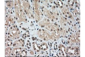 Image no. 2 for anti-Mitogen-Activated Protein Kinase Kinase 4 (MAP2K4) antibody (ABIN1499480)