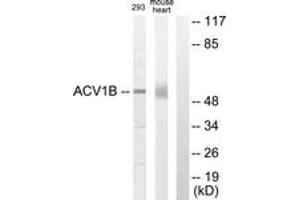 Western blot analysis of extracts from 293/mouse liver cells, using ACV1B Antibody. (Activin A Receptor Type IB/ALK-4 anticorps  (AA 73-122))