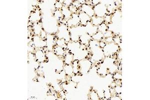 Immunohistochemistry of paraffin embedded mouse lung using rap1 (ABIN7075857) at dilution of 1: 2000 (400x lens) (RAP1 anticorps)