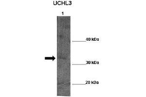 WB Suggested Anti-UCHL5 Antibody  Positive Control: Lane 1:341 µg Zebrafish skin lysate Primary Antibody Dilution: 1:0000Secondary Antibody: Anti-rabbit-HRP Secondry  Antibody Dilution: 1:0000Submitted by: William Tse (UCHL5 anticorps  (Middle Region))