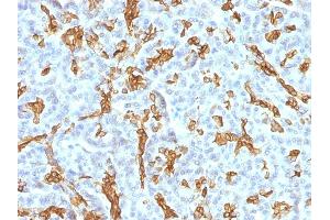 Formalin-fixed, paraffin-embedded human Pancreas stained with Cytokeratin 19 MAb (KRT19/799 + KRT19/800) (Cytokeratin 19 anticorps)