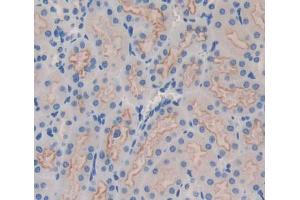 Used in DAB staining on fromalin fixed paraffin- embedded kidney tissue