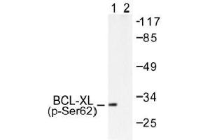 Image no. 1 for anti-BCL2-Like 1 (BCL2L1) (pSer62) antibody (ABIN317973)