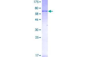 Image no. 1 for Ret Proto-Oncogene (RET) (AA 25-458) protein (GST tag) (ABIN1317814)