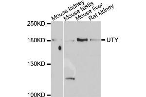 Western blot analysis of extracts of various cell lines, using UTY antibody. (UTY anticorps)