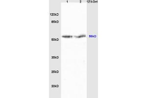 Lane 1: rat liver lysates Lane 2: rat brain lysates probed with Anti Cyp2-j3 Polyclonal Antibody, Unconjugated (ABIN872965) at 1:200 in 4 °C. (Cytochrome P450, Family 2, Subfamily J, Polypeptide 3 (CYP2J3) (AA 401-502) anticorps)