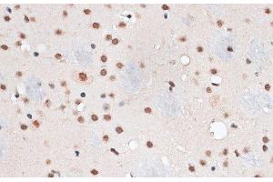 Immunohistochemistry of paraffin-embedded Mouse brain using RBM3 Polyclonal Antibody at dilution of 1:100 (40x lens).