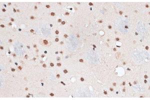 Immunohistochemistry of paraffin-embedded Mouse brain using RBM3 Polyclonal Antibody at dilution of 1:100 (40x lens). (RBM3 anticorps)