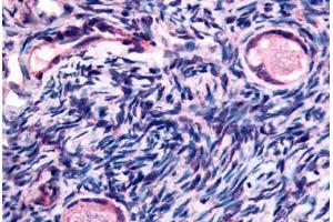 anti-Transmembrane Protein 5 (TMEM5) (Extracellular Domain) antibody