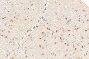 Immunohistochemistry analysis of paraffin-embedded mouse brain using,GDF6 (ABIN7074132) at dilution of 1: 1000