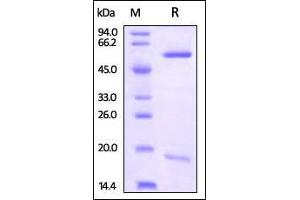 Rhesus macaque PCSK9, His Tag on SDS-PAGE under reducing (R) condition.