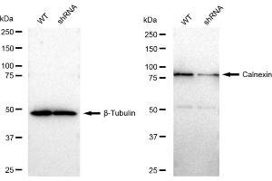 Western blotting analysis using Calnexin antibody (ABIN7797845).