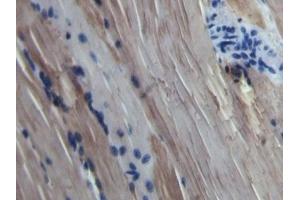 Detection of MYO in Bovine Skeletal muscle Tissue using Polyclonal Antibody to Myoglobin (MYO) (Myoglobin anticorps  (AA 1-154))