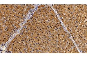 Detection of STAT2 in Porcine Liver Tissue using Polyclonal Antibody to Signal Transducer And Activator Of Transcription 2 (STAT2)