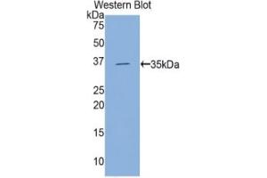 WB of Protein Standard: different control antibodies against Highly purified E. (Hexokinase 2 Kit ELISA)