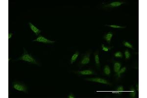 Immunofluorescence of monoclonal antibody to MKNK1 on HeLa cell. (MKNK1 anticorps  (AA 1-100))
