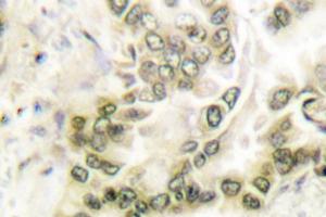 Image no. 1 for anti-Histone Deacetylase 1 (HDAC1) antibody (ABIN265453)