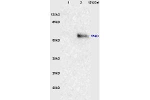 Lane 1: mouse lung lysates Lane 2: human colon carcinoma lysates probed with Anti-NRF-1 Polyclonal Antibody, Unconjugated (ABIN675219) at 1:200 in 4 °C. (NRF1 anticorps  (AA 51-180))