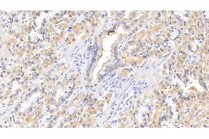 Detection of IL1RA in Human Stomach Tissue using Monoclonal Antibody to Interleukin 1 Receptor Antagonist (IL1RA)