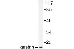 Image no. 2 for anti-Gastrin (GAST) antibody (ABIN265432)