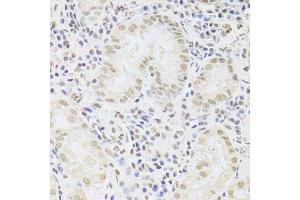 Immunohistochemistry of paraffin-embedded human stomach using SNRPA Antibody. (SNRPA1 anticorps  (AA 1-282))
