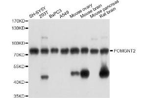 Western blot analysis of extracts of various cell lines, using POMGNT2 antibody (ABIN6289951) at 1:3000 dilution. (C3orf39 anticorps)