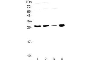 anti-Phorbolin 1 (AA 1-63) antibody