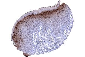 Skin In the skin a nuclear and cytoplasmic Cystatin A immunostaining is predominantly seen in the granular cell layer. (CSTA anticorps)