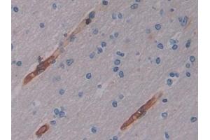 anti-Cytohesin 2 (CYTH2) (AA 1-390) antibody