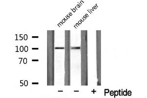 Western blot analysis on HuvEc cell lysate using NARG1 Antibody (NAA15 anticorps  (Internal Region))