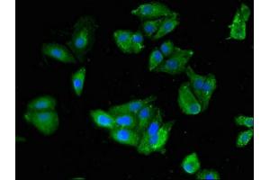 Immunofluorescent analysis of HepG2 cells using ABIN7169773 at dilution of 1:100 and Alexa Fluor 488-congugated AffiniPure Goat Anti-Rabbit IgG(H+L) (SKIL anticorps  (AA 359-579))