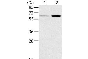 Western Blot analysis of Human liver and Mouse kidney tissue using TNFRSF11A Polyclonal Antibody at dilution of 1:200 (TNFRSF11A anticorps)