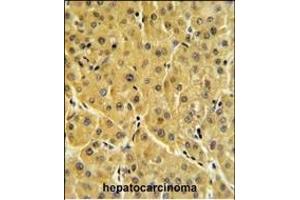 anti-Fructose-1,6-Bisphosphatase 1 (FBP1) (AA 1-31), (N-Term) antibody