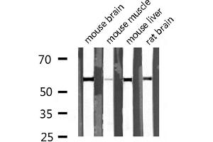Western blot analysis of extracts of various tissue sample,using DUS2L Antibody . (DUSL2 anticorps  (C-Term))