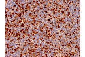 Formalin-fixed, paraffin-embedded human Lymph Node stained withAnnexin A1 Mouse Monoclonal Antibody (ANXA1/3566).