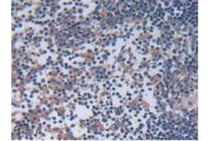 IHC-P analysis of Rat Lymph Node Tissue, with DAB staining. (IL12A anticorps  (AA 23-215))