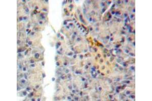 Used in DAB staining on fromalin fixed paraffin-embedded pancreas tissue