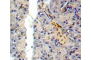 Used in DAB staining on fromalin fixed paraffin-embedded pancreas tissue (SEMA7A anticorps  (AA 318-566))