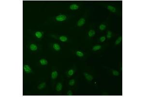 IF analysis of NPR1 using anti-NPR1 antibody (ABIN7602080).