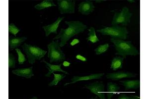Immunofluorescence of purified MaxPab antibody to TRGV3 on HeLa cell. (TRGV3 anticorps  (AA 1-200))
