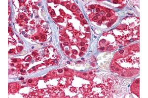 Immunohistochemical analysis of paraffin-embedded human Kidney tissues using GPI mouse mAb. (GPI anticorps)