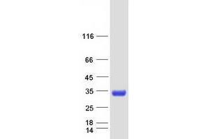 Validation with Western Blot