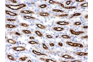 IHC testing of FFPE mouse kidney with SLC12A1 antibody. (SLC12A1 anticorps)